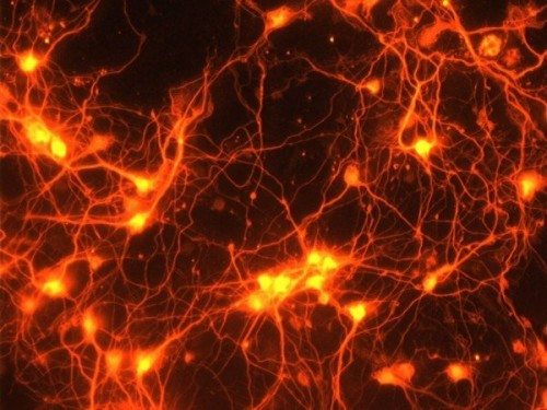 Deep brain’s electrical stimulation alleviates chronic pain: Study